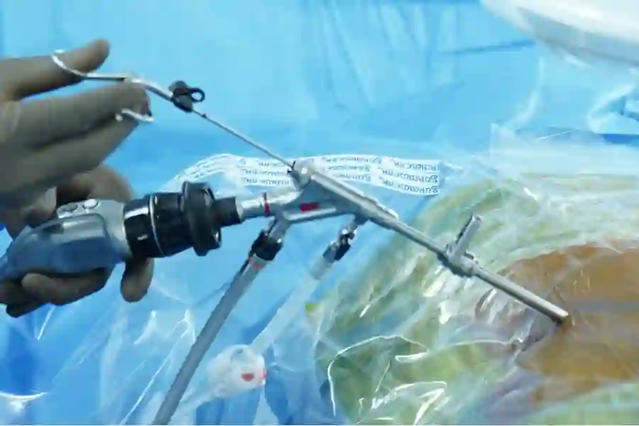 Full Endoscopic Spine Surgery